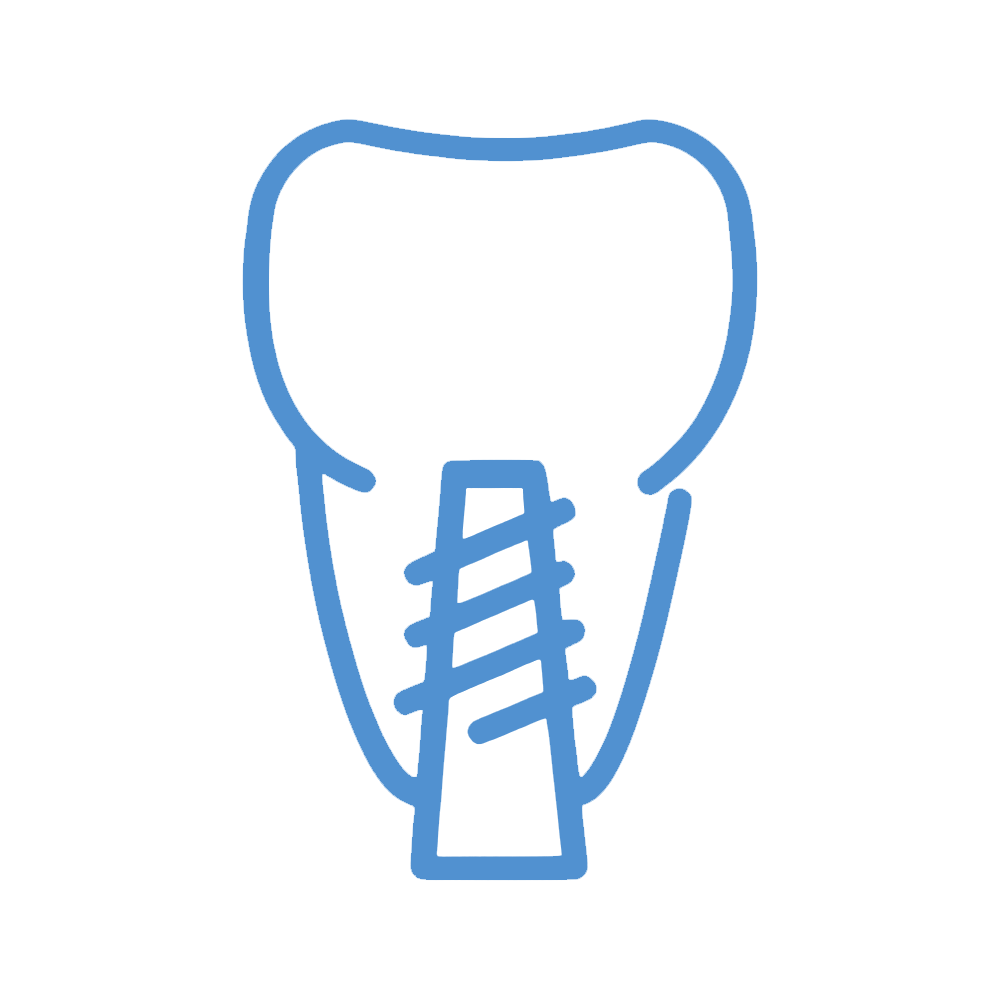 Dentamaris Dental Clinic Implant