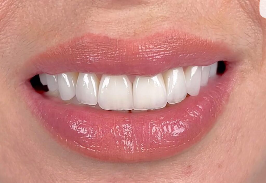 Dentamaris Dental Clinic Smile Design