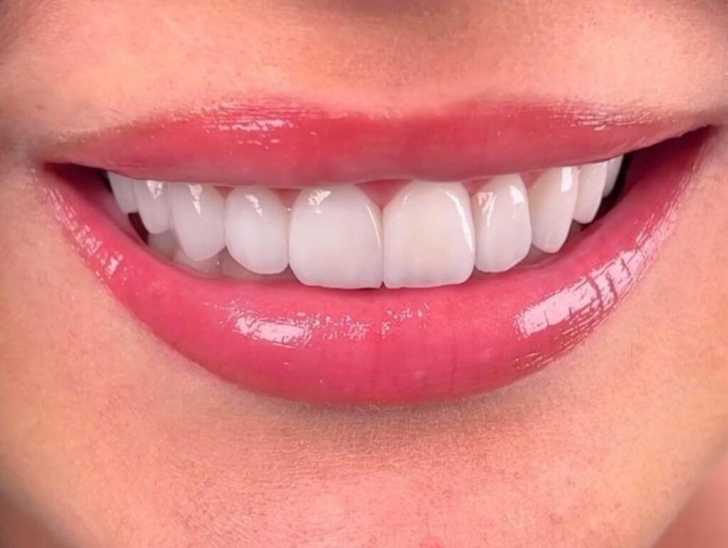 Dentamaris Dental Clinic Smile Design