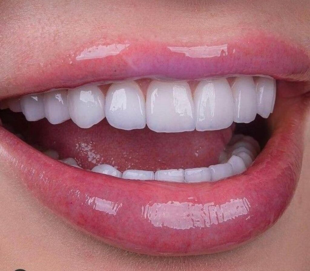 Dentamaris Dental Clinic Smile Design