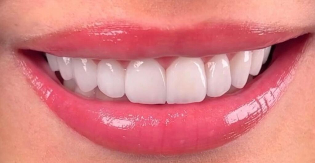 Dentamaris Dental Clinic Smile Design