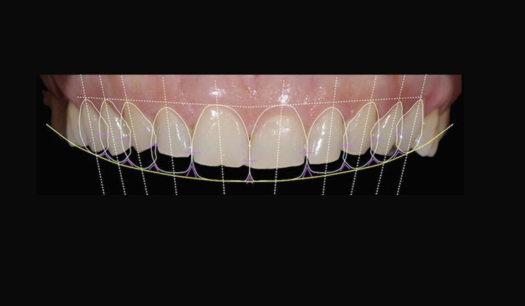 Dentamaris Dental Clinic Smile Design