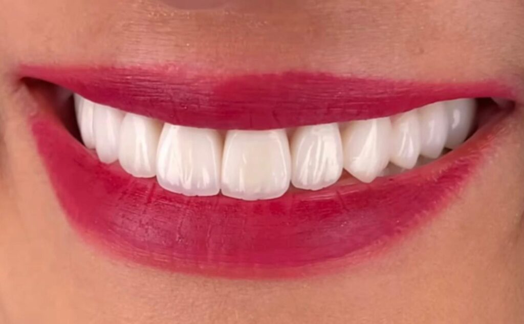 Dentamaris Dental Clinic Smile Design