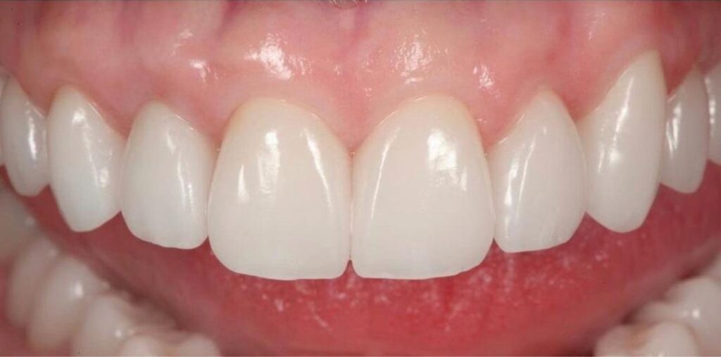 Dentamaris Dental Clinic Smile Design