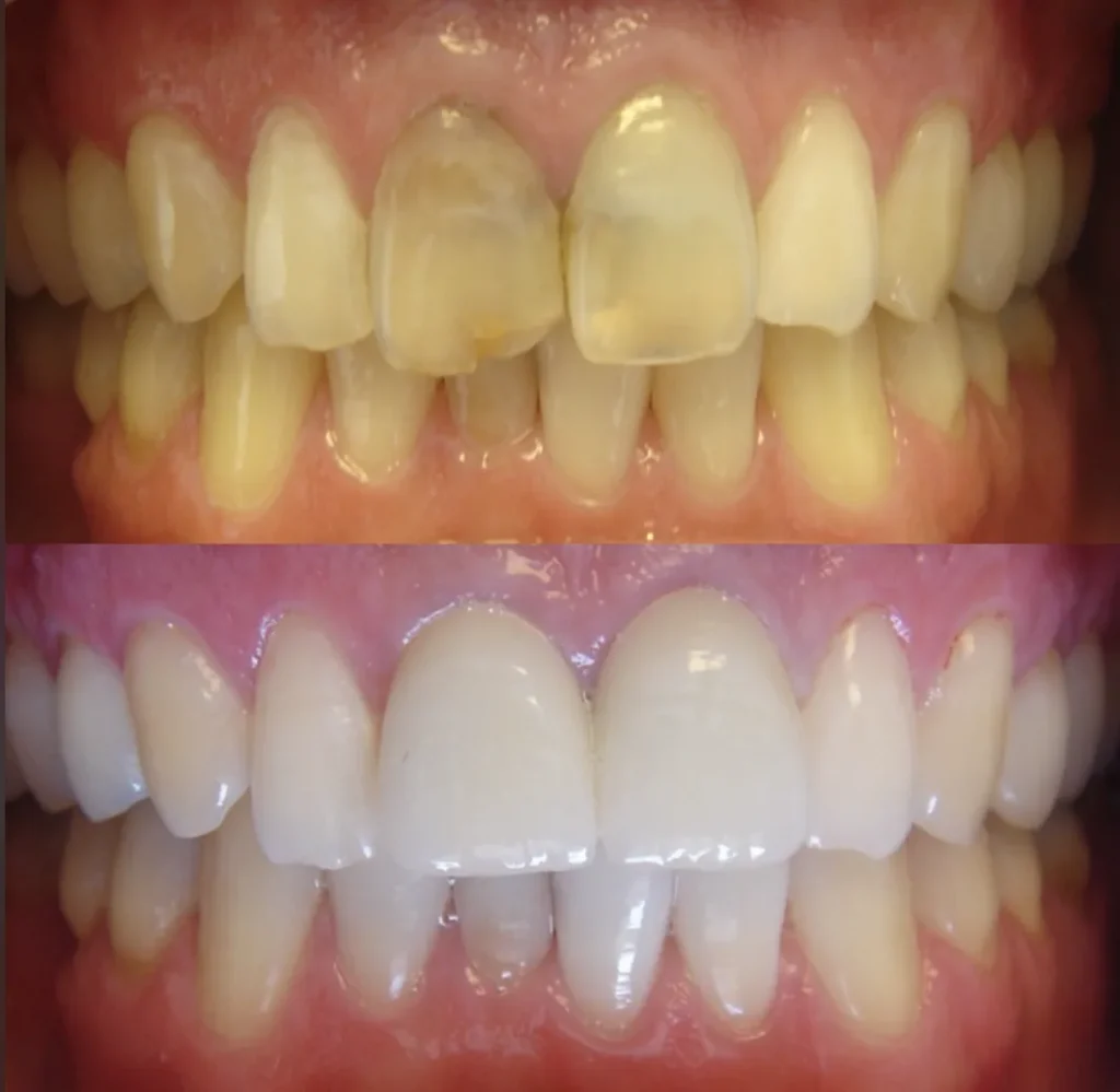 Dentamaris Dental Clinic Smile Design