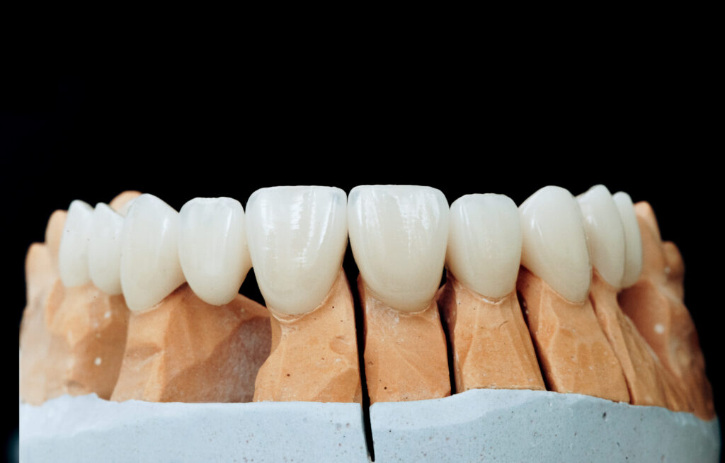 Dentamaris Dental Clinic Zirconium