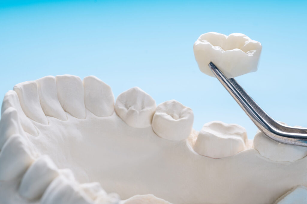 Dentamaris Dental Clinic Zirconium